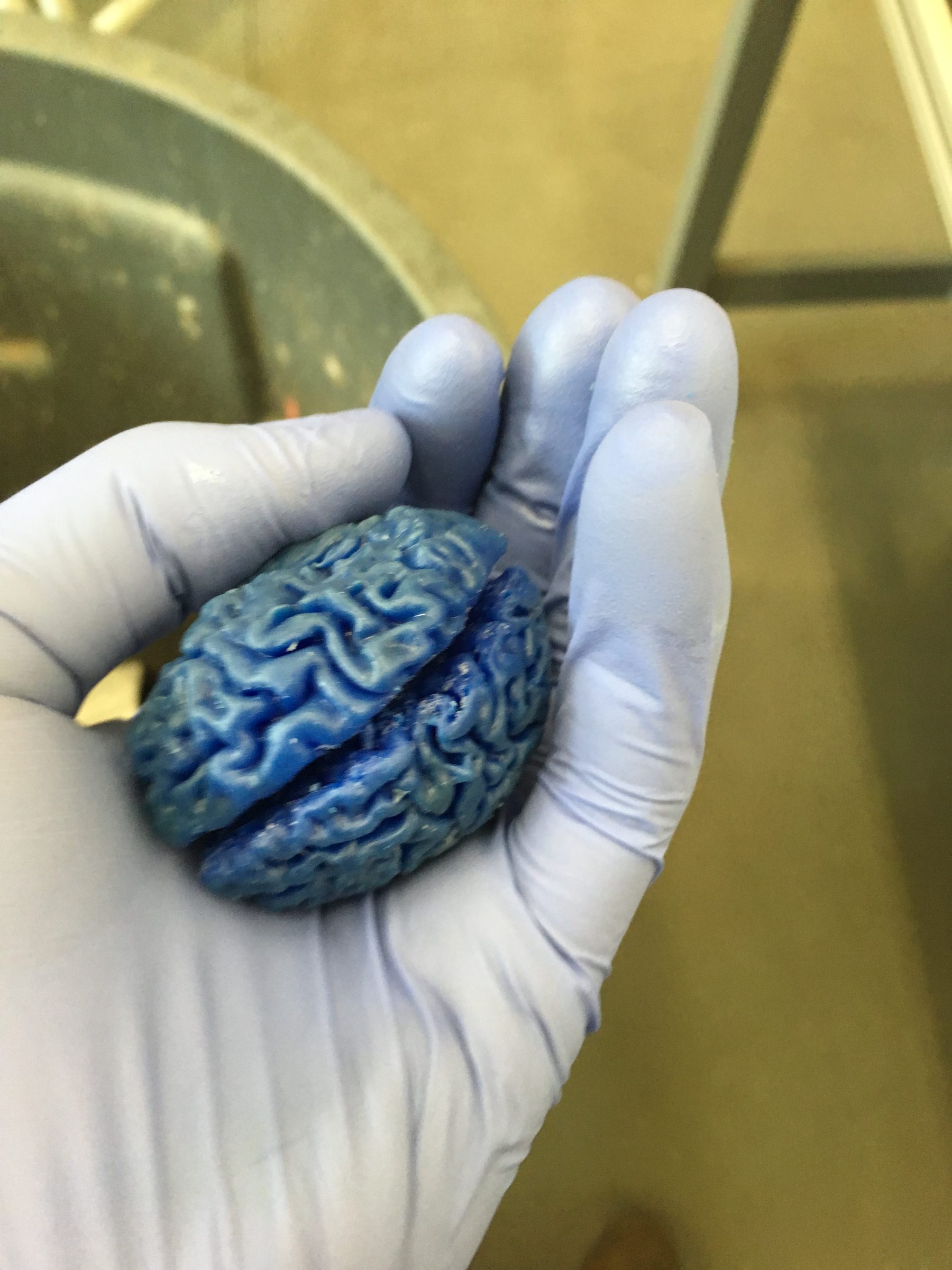 Brain